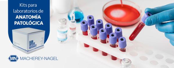 Extracción de ácidos nucleicos de biopsias líquidas y sólidas